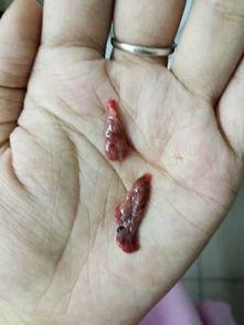 流产后吃黑瓜好吗有影响吗,流产后食用黑瓜的影响与注意事项