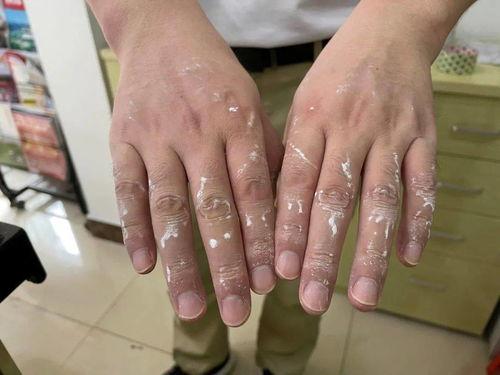 今日瓜埠核酸检测点,守护健康防线，共筑平安家园