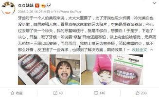 明星网红的牙齿图片,完美笑容背后的秘密