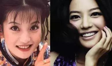 明星网红的牙齿图片,完美笑容背后的秘密