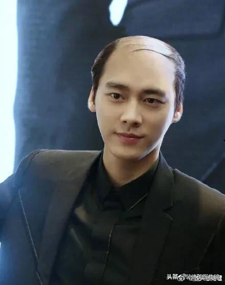 国外秃头的明星网红,揭秘国外秃头明星网红的独特风采