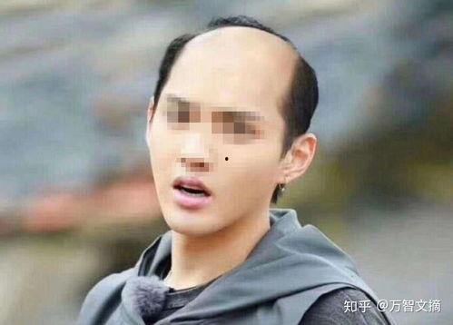 国外秃头的明星网红,揭秘国外秃头明星网红的独特风采