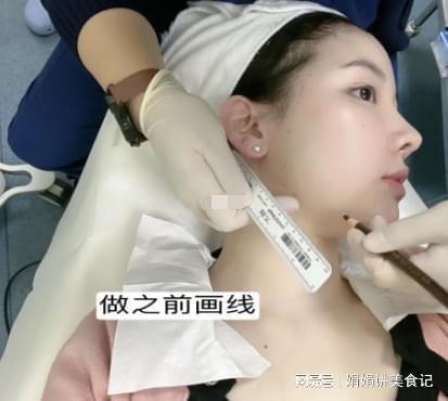 半岛超声炮明星网红,网红追捧的医美新宠，揭秘明星美颜的秘密武器